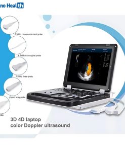 Karestar K-C500 3D/4D Color Doppler Ultrasound Machine 3 Features of Karestar K‑C500 Ultrasound Machine