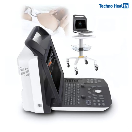 Karestar K-C105 Digital Color Ultrasound Machine 1 Karestar K-C105 Digital Color Ultrasound Machine