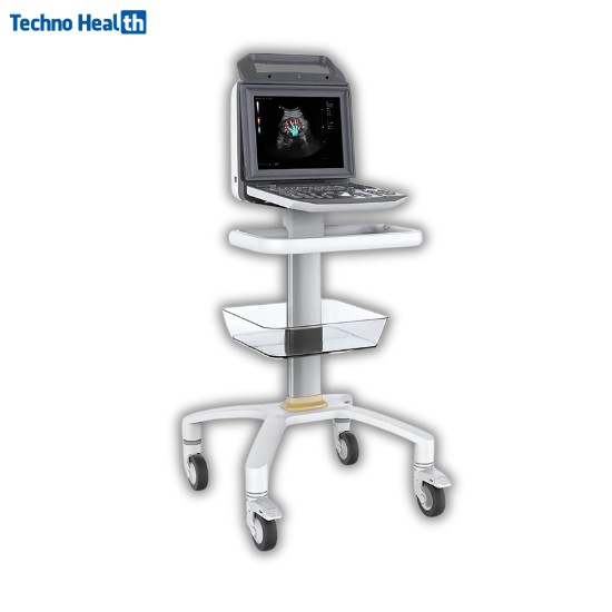 Karestar K-C105 Digital Color Ultrasound Machine 2 Karestar K-C105 Digital Color Ultrasound Machine - Image 2