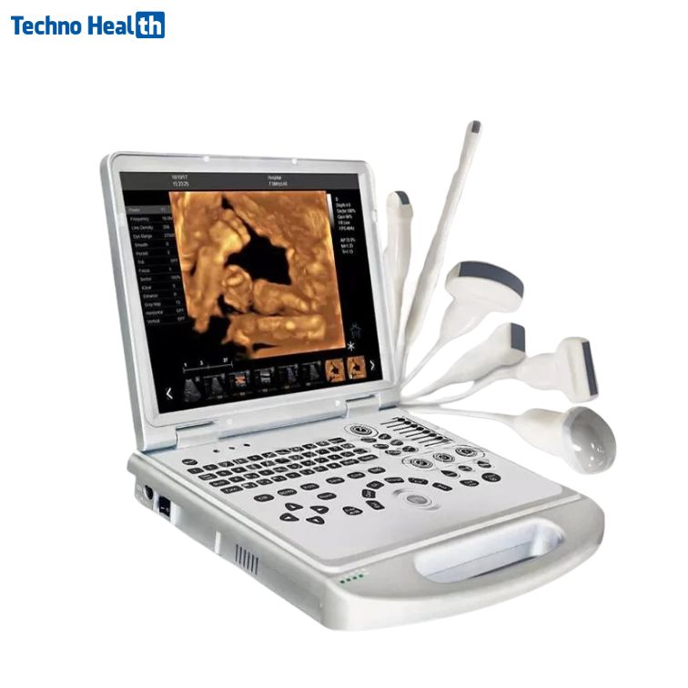 Karestar K-C300 Portable Ultrasound Machine 2 Karestar K-C300 Color Doppler Portable Ultrasound Machine