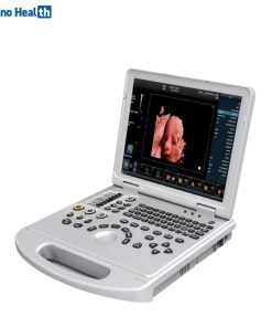 Karestar K-C300 Portable Ultrasound Machine