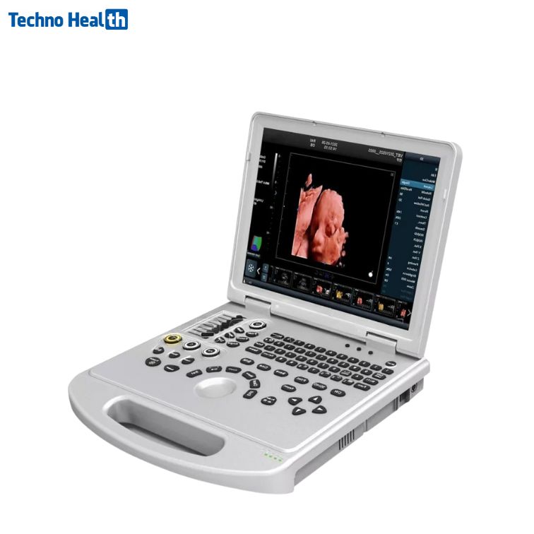 Karestar K-C300 Portable Ultrasound Machine 1 Karestar K-C300 Portable Ultrasound Machine