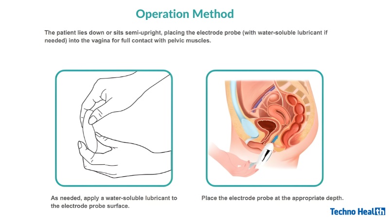 How to Use - XFT-0010EA Pelvic Muscle Trainer