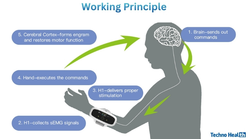 Working Principle of XFT-2003E H1 Hand Rehab System