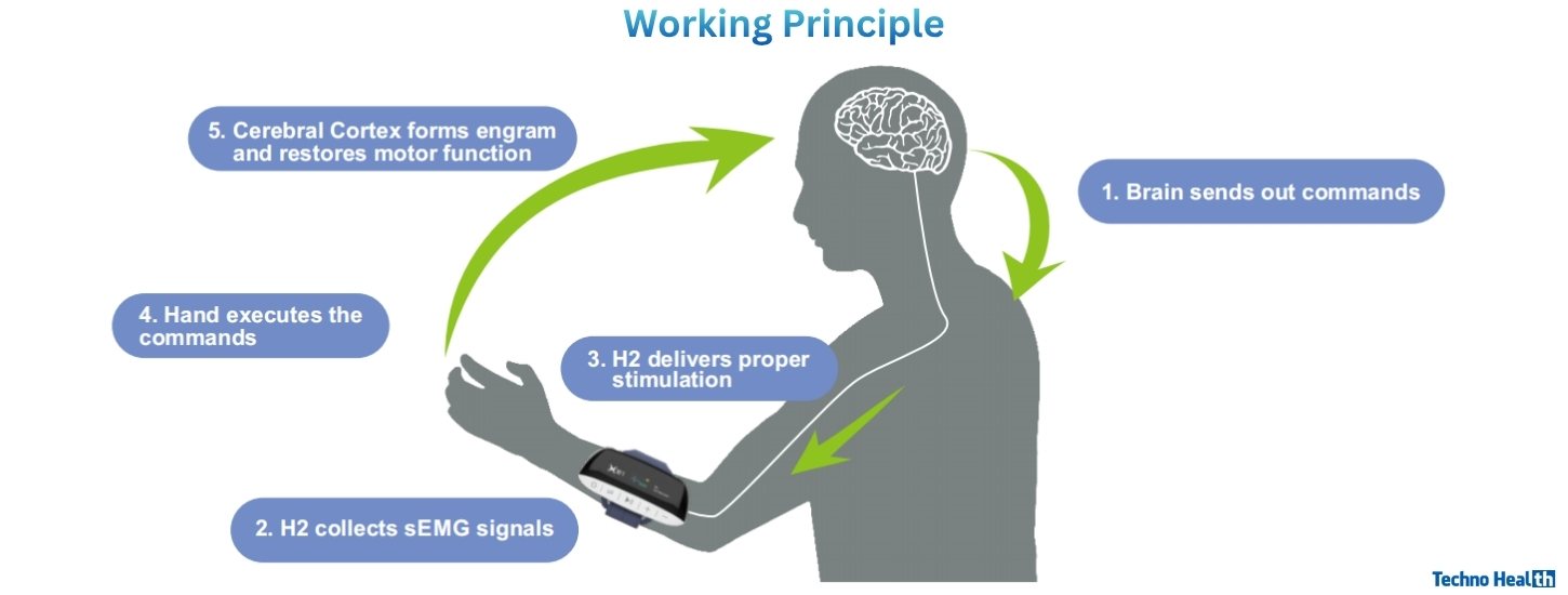 Working Principle of XFT-2003EA H2 Hand Rehab System