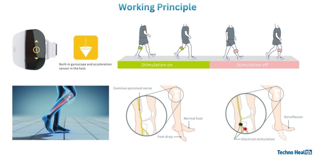 XFT-2001E G4 Foot Drop System