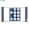 Ecomed EV-750MT LED X-Ray View Box - Double View 2 Ecomed EV-750MT LED X-Ray View Box - Double