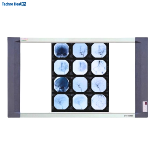 Ecomed EV-750MT LED X-Ray View Box - Double View 1 Ecomed EV-750MT LED X-Ray View Box - Double